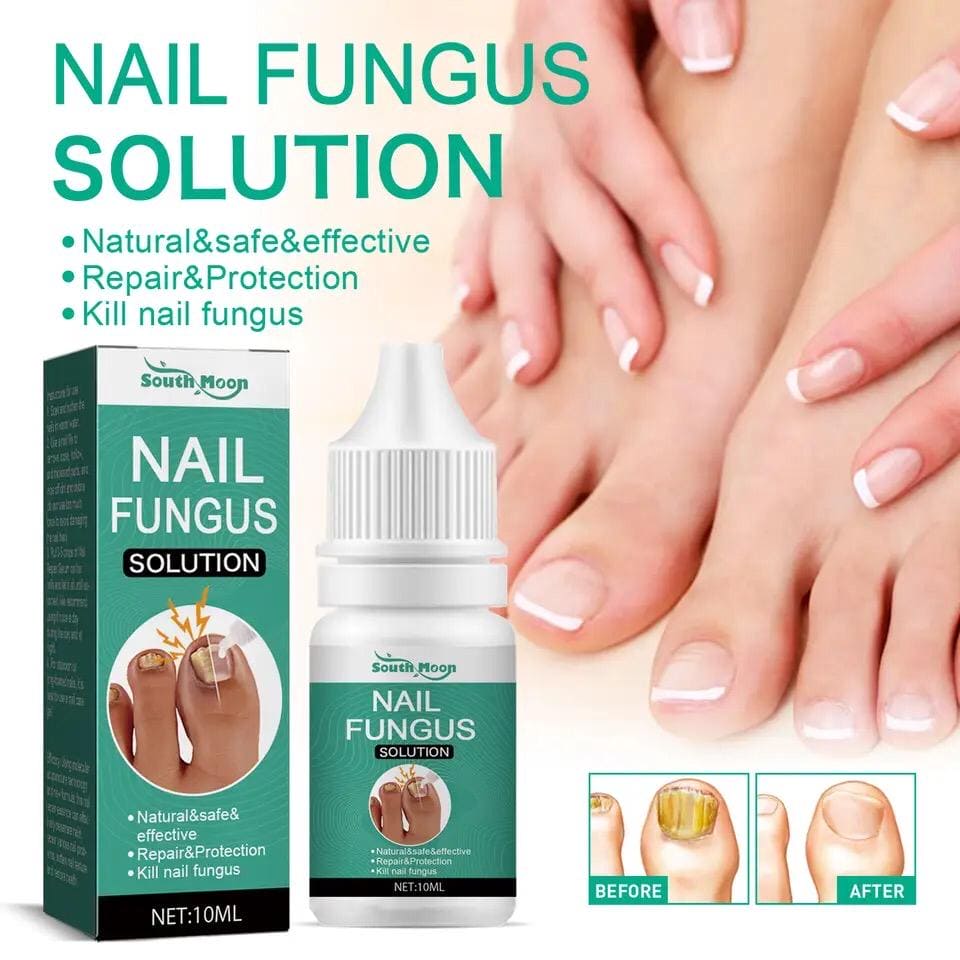 Nail Fungus Solution, Anti Infection Nail Fungus Removal Gel, Ingrown Toenail Treatment Nail Care Oil, Nail Fungus Treatments Serum Nail Fungus Solution, Anti Infection Nail Fungus Removal Gel, Ingrown Toenail Treatment Nail Care Oil, Nail Fungus Treatments Serum